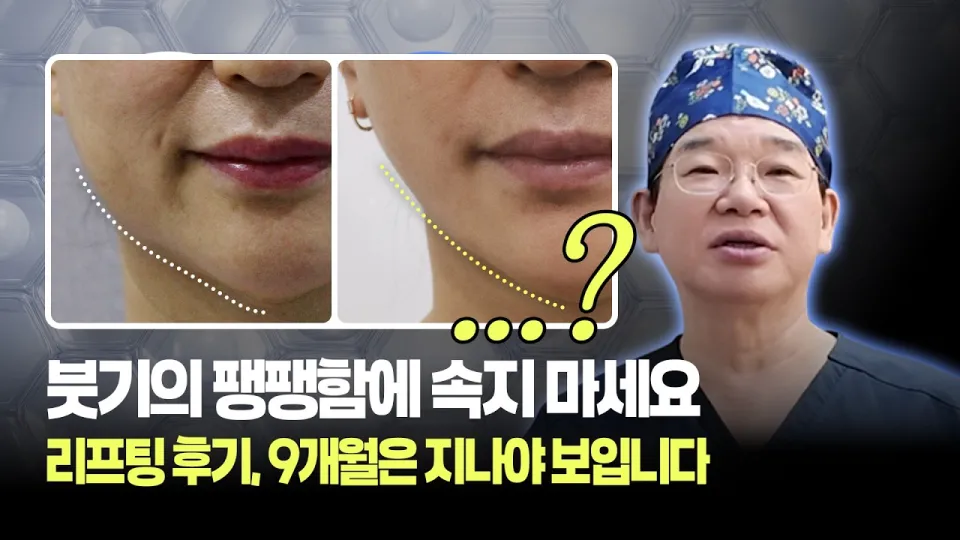 7가지 핵심으로 알아보는 리프팅시술 효과와 관리법
